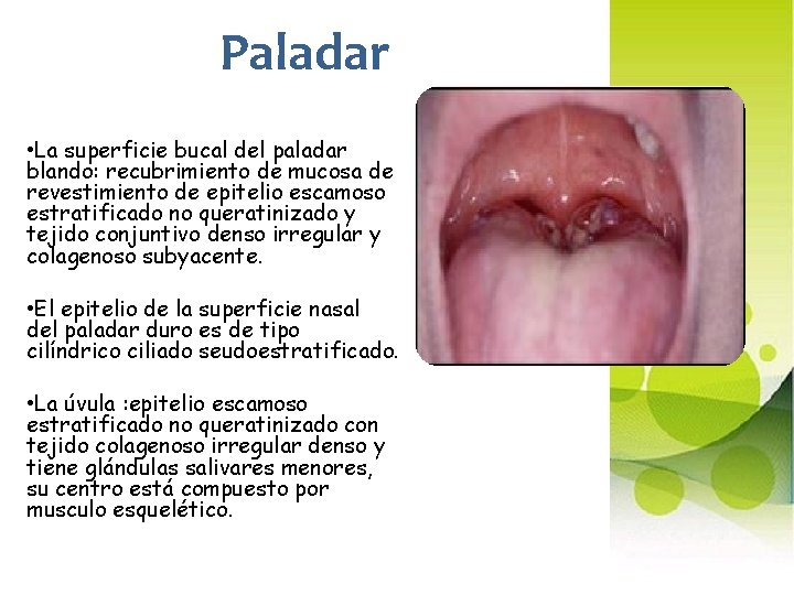 Paladar • La superficie bucal del paladar blando: recubrimiento de mucosa de revestimiento de