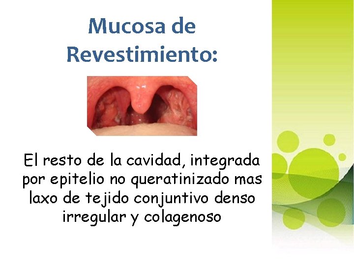 Mucosa de Revestimiento: El resto de la cavidad, integrada por epitelio no queratinizado mas