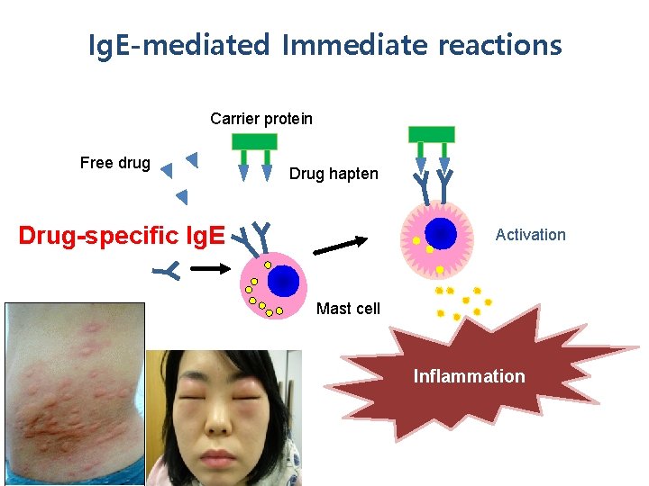 Ig. E-mediated Immediate reactions Carrier protein Free drug Drug hapten Drug-specific Ig. E Activation