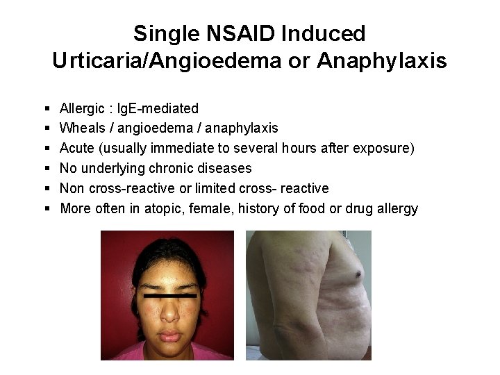 Single NSAID Induced Urticaria/Angioedema or Anaphylaxis § § § Allergic : Ig. E-mediated Wheals