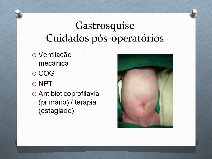 Gastrosquise Cuidados pós-operatórios O Ventilação mecânica O COG O NPT O Antibioticoprofilaxia (primário) /