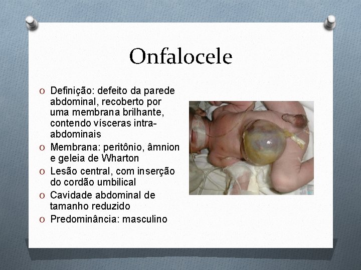 Onfalocele O Definição: defeito da parede O O abdominal, recoberto por uma membrana brilhante,