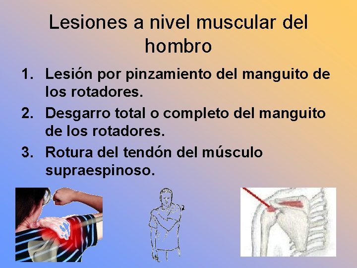 Lesiones a nivel muscular del hombro 1. Lesión por pinzamiento del manguito de los