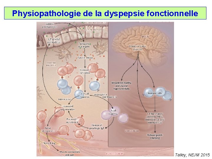 Physiopathologie de la dyspepsie fonctionnelle Talley, NEJM 2015 