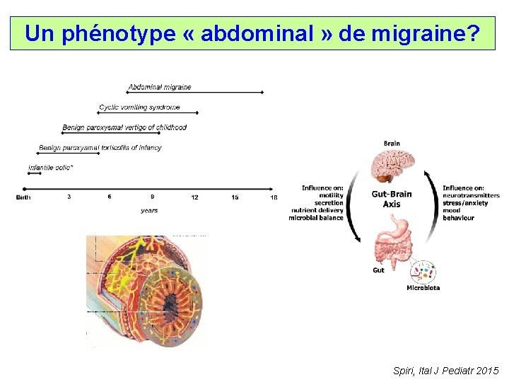 Un phénotype « abdominal » de migraine? Spiri, Ital J Pediatr 2015 