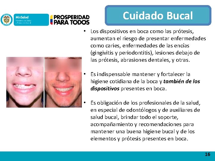 Cuidado Bucal • Los dispositivos en boca como las prótesis, aumentan el riesgo de