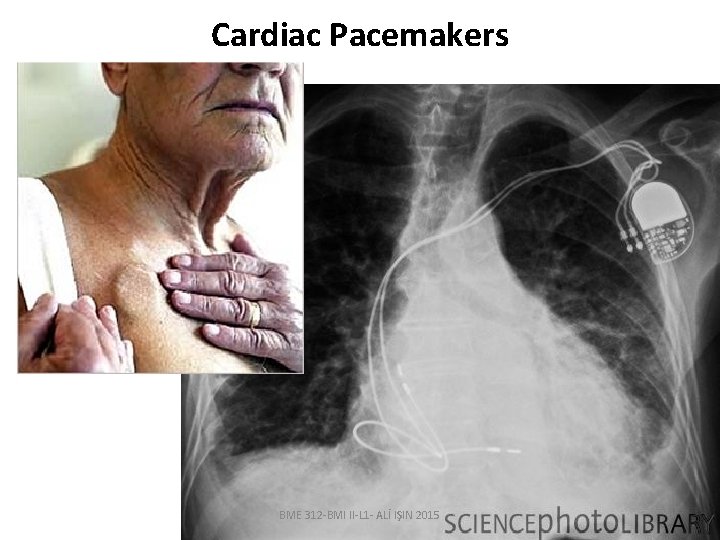 Cardiac Pacemakers BME 312 -BMI II-L 1 - ALİ IŞIN 2015 