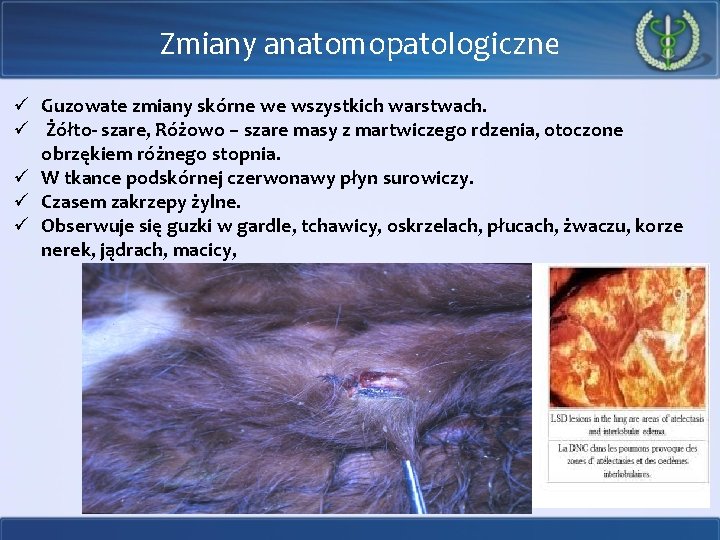 Zmiany anatomopatologiczne ü Guzowate zmiany skórne we wszystkich warstwach. ü Żółto- szare, Różowo –