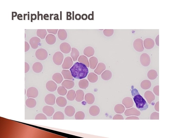 Peripheral Blood 