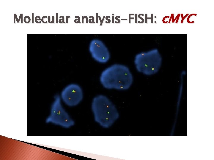 Molecular analysis-FISH: c. MYC 