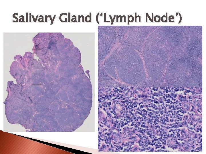 Salivary Gland (‘Lymph Node’) 