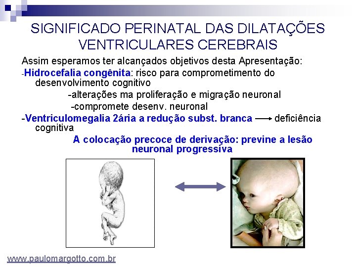 SIGNIFICADO PERINATAL DAS DILATAÇÕES VENTRICULARES CEREBRAIS Assim esperamos ter alcançados objetivos desta Apresentação: -Hidrocefalia