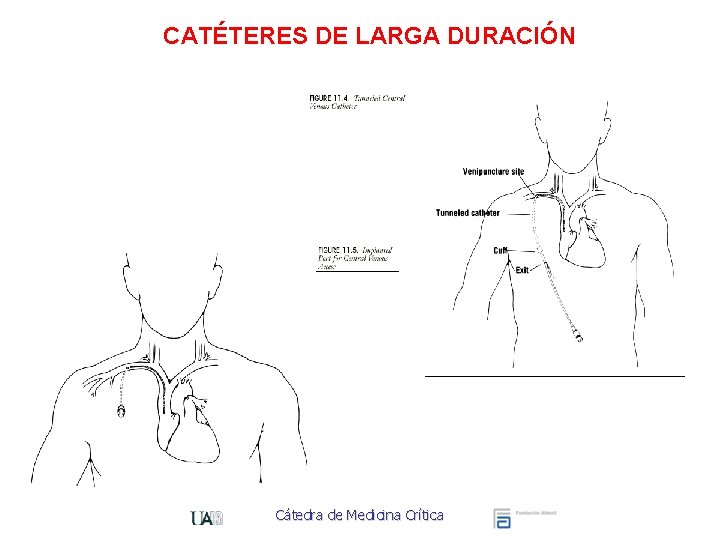 CATÉTERES DE LARGA DURACIÓN Cátedra de Medicina Crítica 