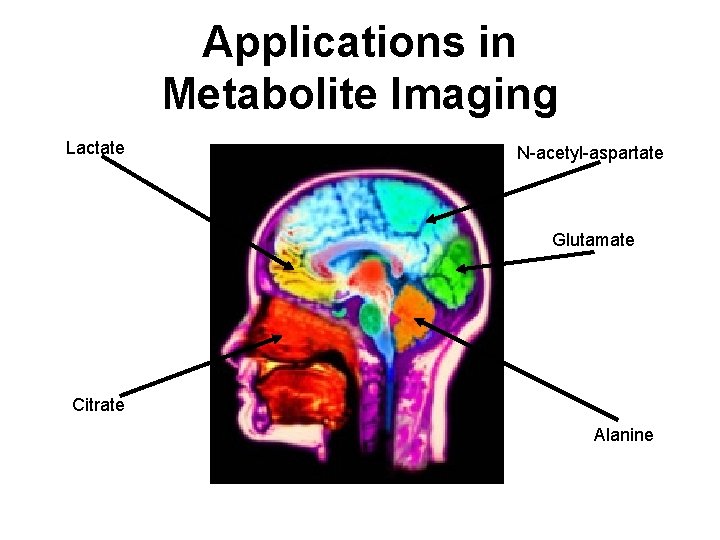 Applications in Metabolite Imaging Lactate N-acetyl-aspartate Glutamate Citrate Alanine 