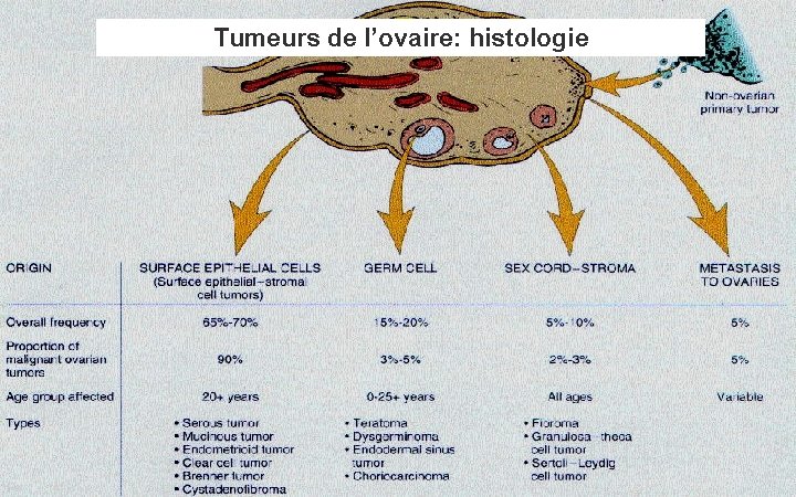 Tumeurs de l’ovaire: histologie 