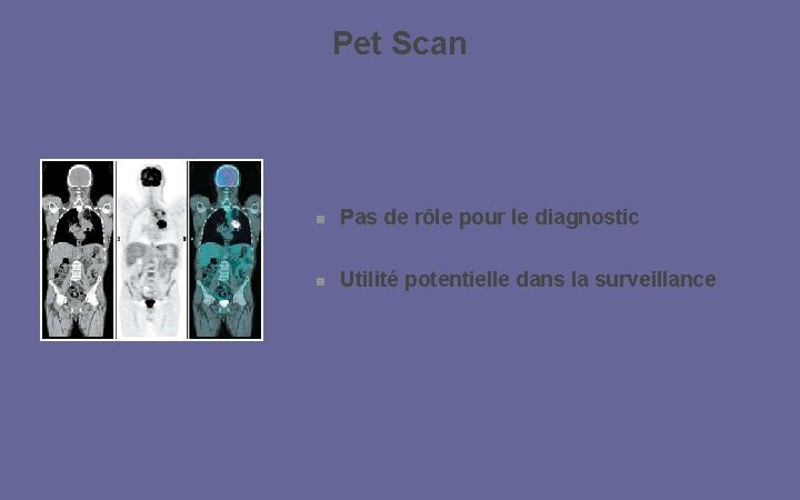Pet Scan Pas de rôle pour le diagnostic Utilité potentielle dans la surveillance 