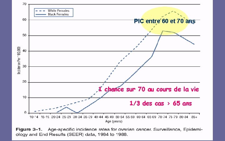 PIC entre 60 et 70 ans 1 chance sur 70 au cours de la