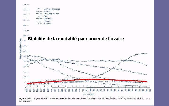 Stabilité de la mortalité par cancer de l’ovaire 