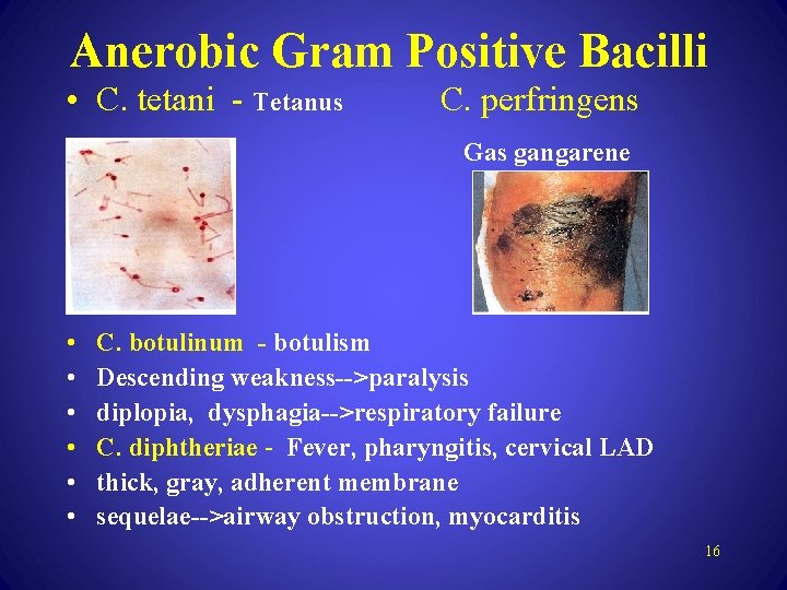 Anerobic Gram Positive Bacilli • C. tetani - Tetanus • • C. perfringens Gas