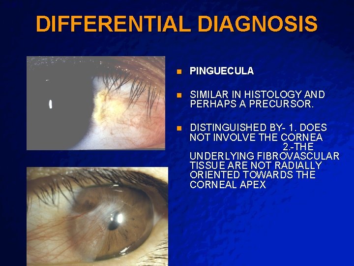 Slide 5 © 2003 By Default! DIFFERENTIAL DIAGNOSIS A Free sample background from www.