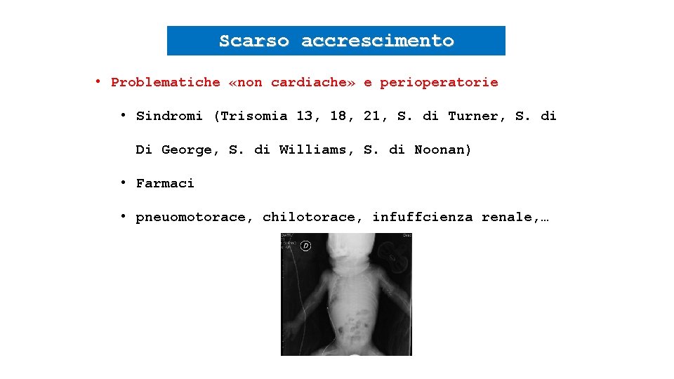 Scarso accrescimento • Problematiche «non cardiache» e perioperatorie • Sindromi (Trisomia 13, 18, 21,