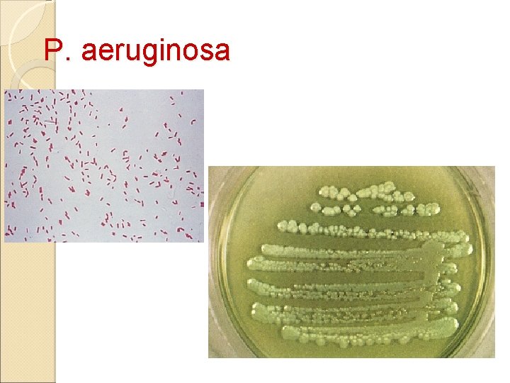 P. aeruginosa 