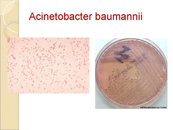 Acinetobacter baumannii 