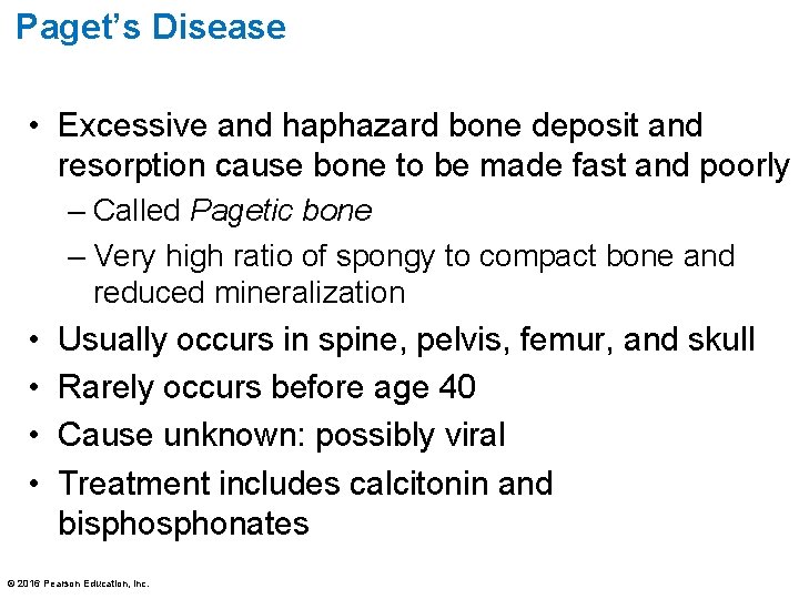 Paget’s Disease • Excessive and haphazard bone deposit and resorption cause bone to be