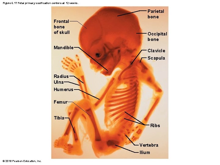 Figure 6. 17 Fetal primary ossification centers at 12 weeks. Frontal bone of skull