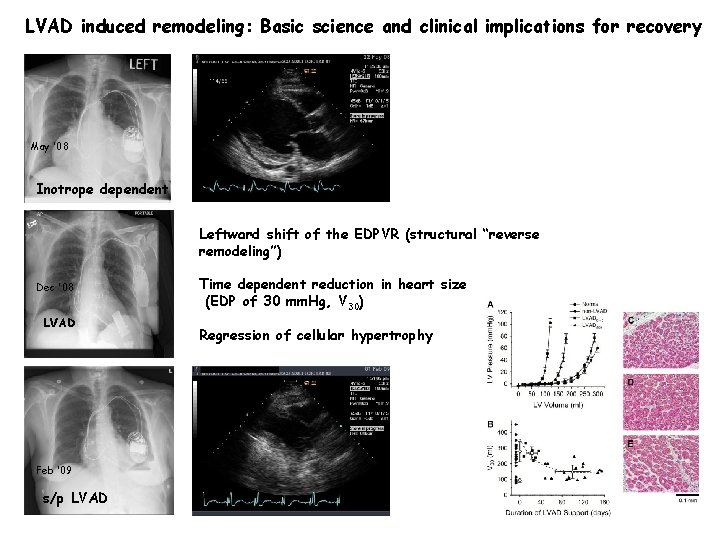LVAD induced remodeling: Basic science and clinical implications for recovery May ‘ 08 Inotrope