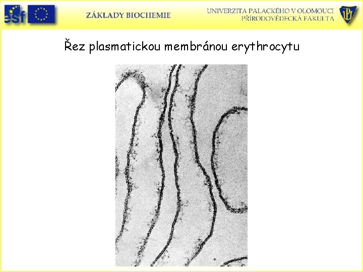 Řez plasmatickou membránou erythrocytu 