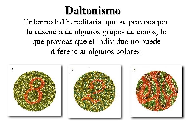 Daltonismo Enfermedad hereditaria, que se provoca por la ausencia de algunos grupos de conos,