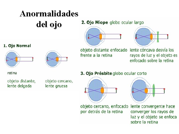 Anormalidades del ojo 