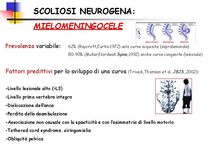 SCOLIOSI NEUROGENA: MIELOMENINGOCELE Prevalenza variabile: 62% (Raycroft, Curtis. 1972) solo curve acquisite (sopralesionale) 80