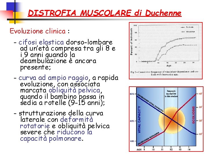 DISTROFIA MUSCOLARE di Duchenne Evoluzione clinica : - cifosi elastica dorso-lombare ad un’età compresa