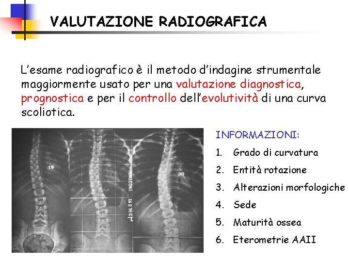 VALUTAZIONE RADIOGRAFICA L’esame radiografico è il metodo d’indagine strumentale maggiormente usato per una valutazione