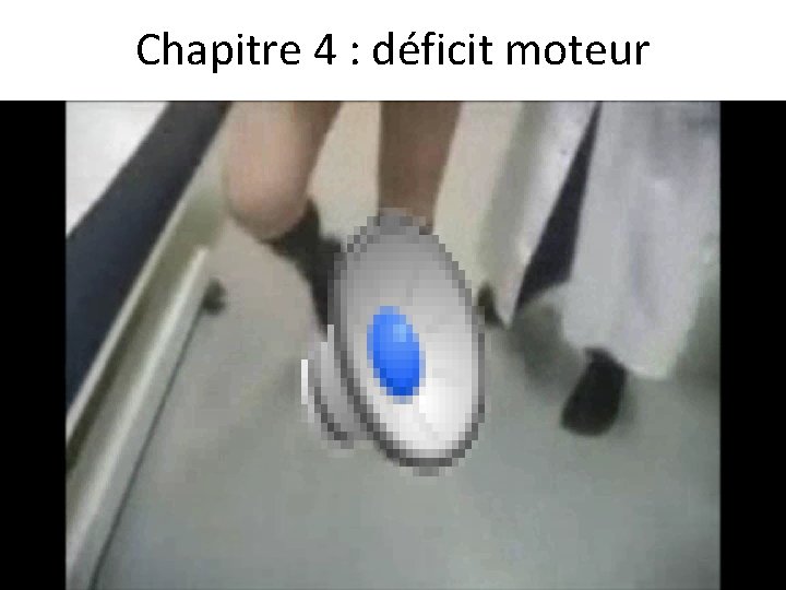 Chapitre 4 : déficit moteur 