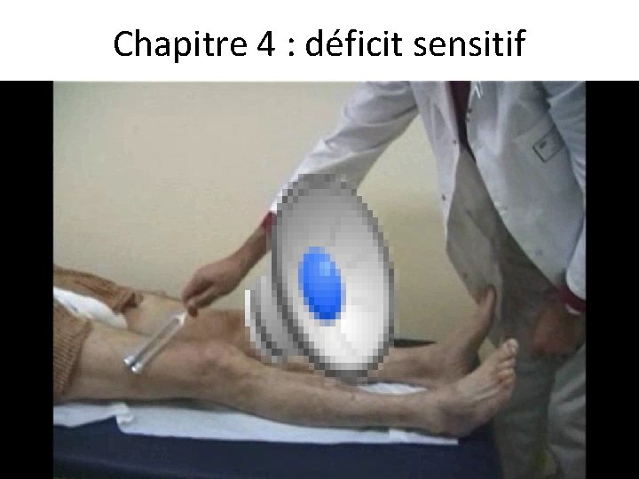 Chapitre 4 : déficit sensitif 