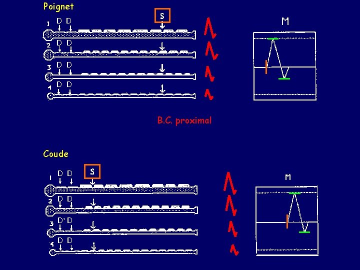 Poignet D D D D B. C. proximal Coude D D D D 