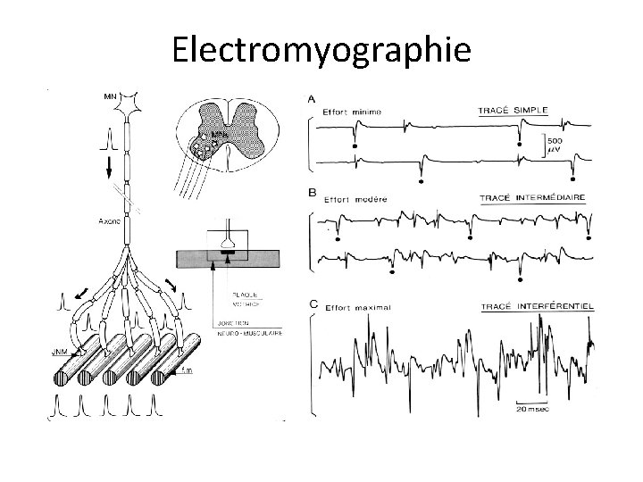 Electromyographie 