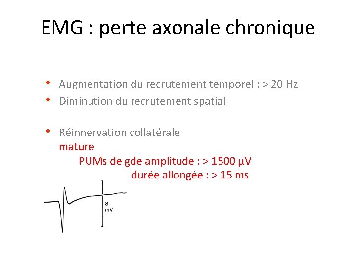 EMG : perte axonale chronique • Augmentation du recrutement temporel : > 20 Hz