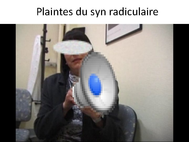 Plaintes du syn radiculaire 
