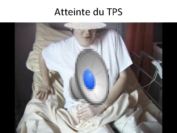 Atteinte du TPS 