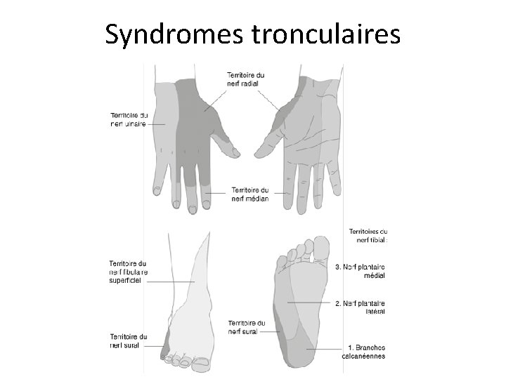 Syndromes tronculaires 