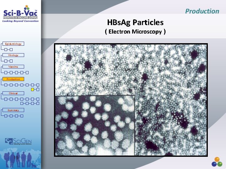 Production HBs. Ag Particles ( Electron Microscopy ) Epidemiology Virology Vaccine Production Clinical Summary