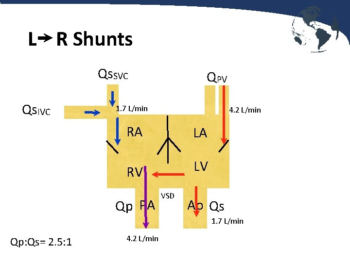 L R Shunts Qs. SVC Qs. IVC QPV 1. 7 L/min 4. 2 L/min