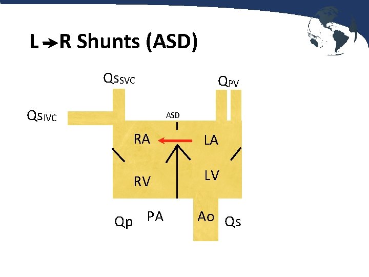 L R Shunts (ASD) Qs. SVC Qs. IVC QPV ASD RA LA RV LV