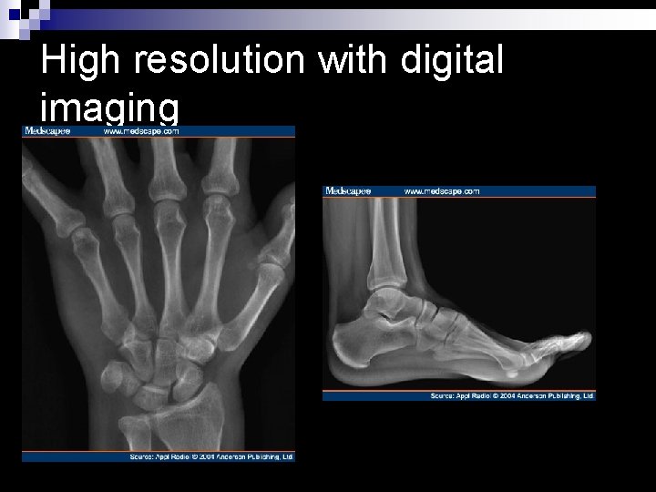 High resolution with digital imaging 