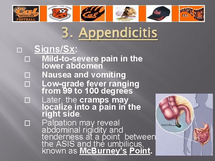 3. Appendicitis Signs/Sx: � � � Mild-to-severe pain in the lower abdomen Nausea and