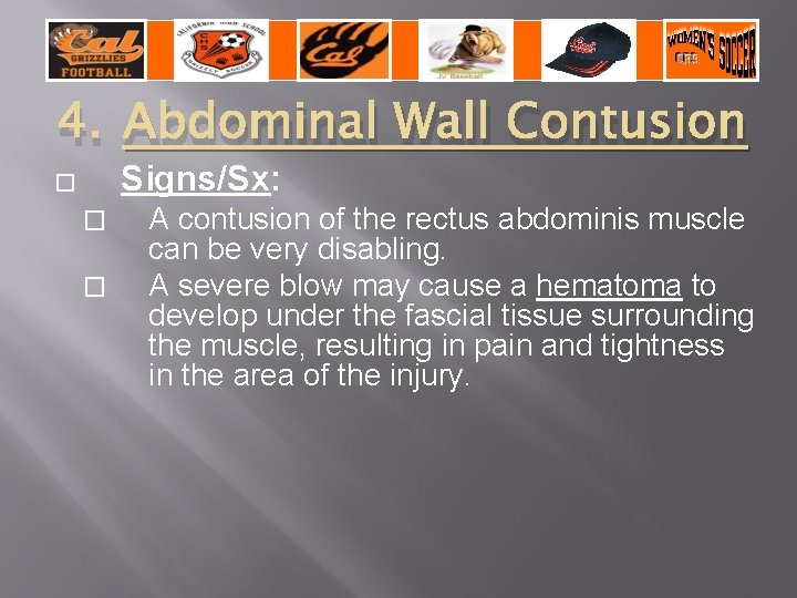 4. Abdominal Wall Contusion Signs/Sx: � � � A contusion of the rectus abdominis
